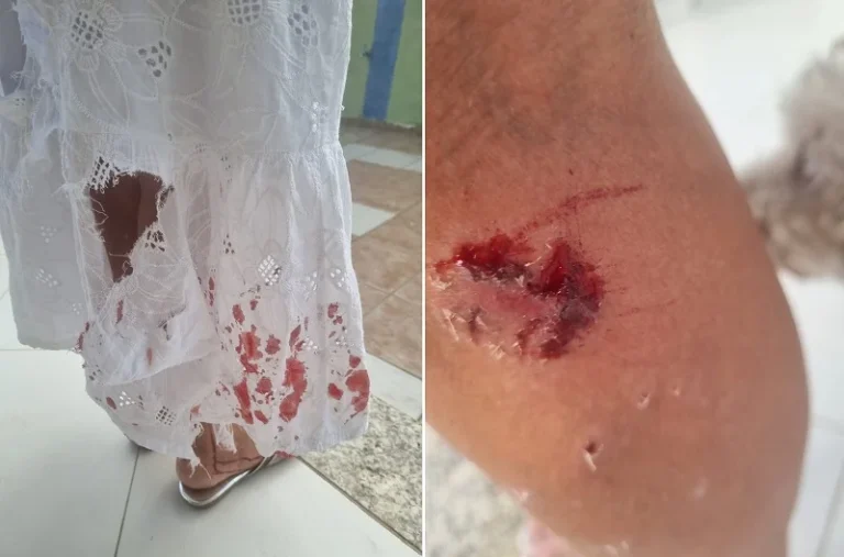 Ataque de Cães em Petrolina: Moradora é Vitima ao Ir à Igreja