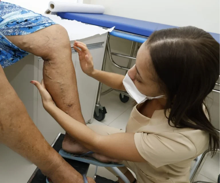 Petrolina Oferece Tratamento de Varizes: Triagens em Rajada e Izacolândia